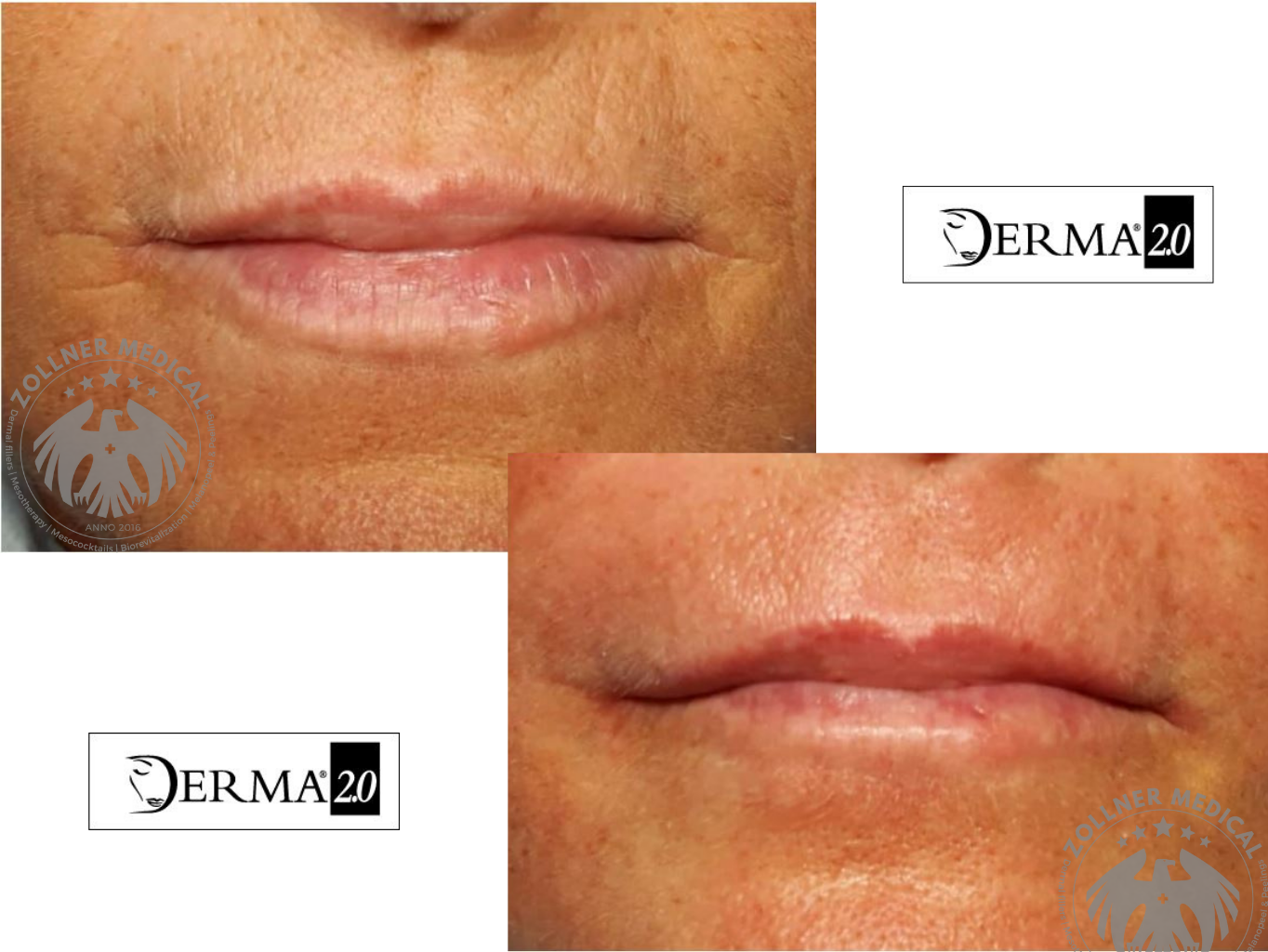 Derma Bio_D2.0